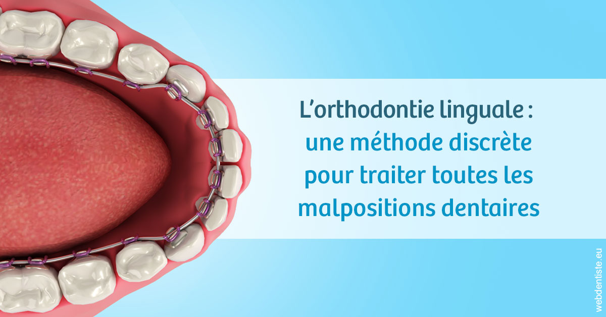 https://dr-ambert-tosi-laurence.chirurgiens-dentistes.fr/L'orthodontie linguale 1