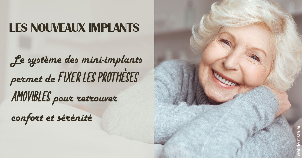 https://dr-ambert-tosi-laurence.chirurgiens-dentistes.fr/Les nouveaux implants 1