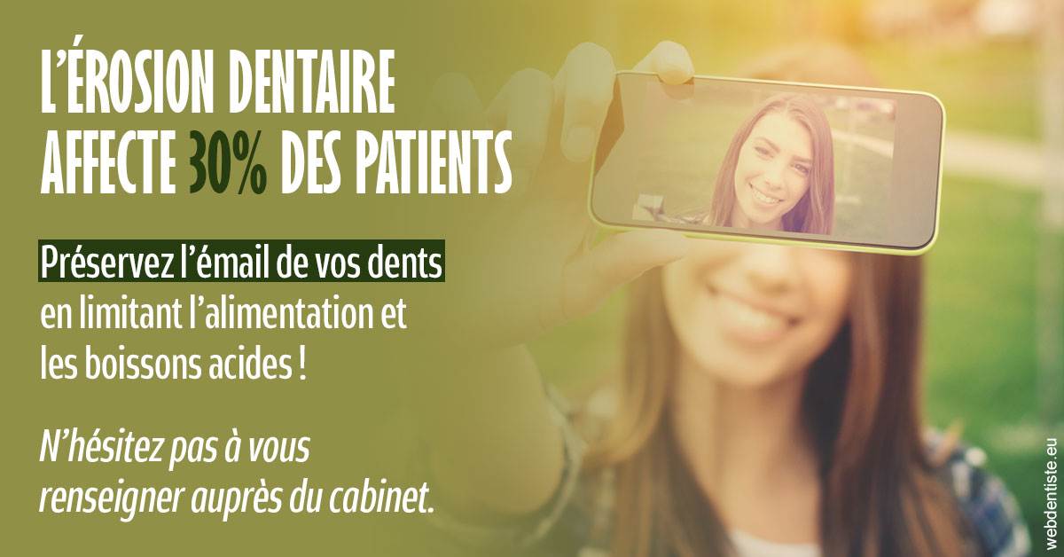 https://dr-ambert-tosi-laurence.chirurgiens-dentistes.fr/L'érosion dentaire 1