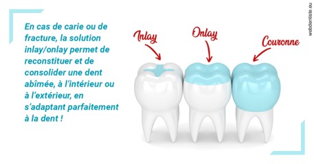 https://dr-ambert-tosi-laurence.chirurgiens-dentistes.fr/L'INLAY ou l'ONLAY