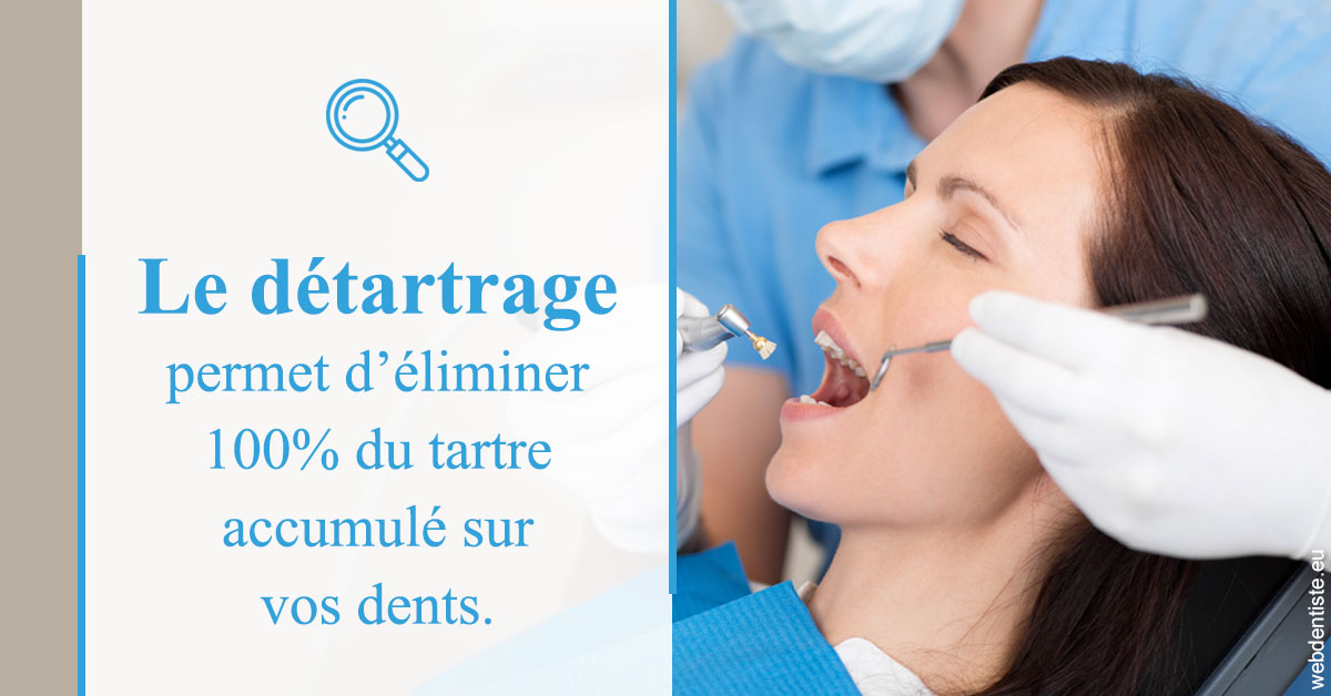 https://dr-ambert-tosi-laurence.chirurgiens-dentistes.fr/En quoi consiste le détartrage