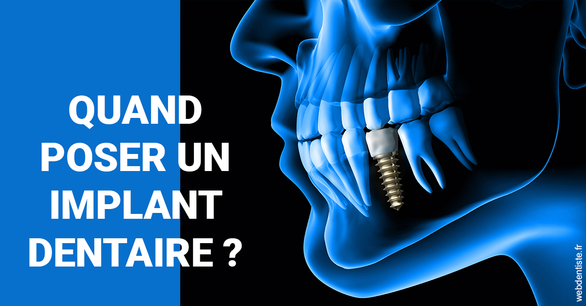 https://dr-ambert-tosi-laurence.chirurgiens-dentistes.fr/Les implants 1