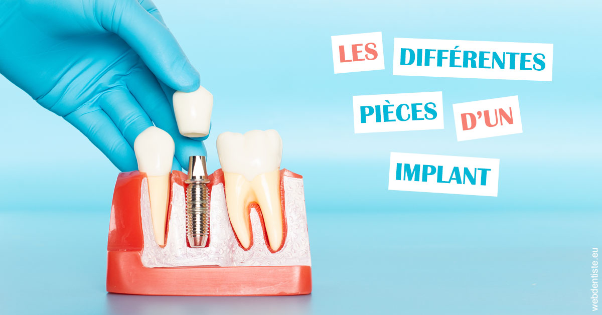 https://dr-ambert-tosi-laurence.chirurgiens-dentistes.fr/Les différentes pièces d’un implant 2