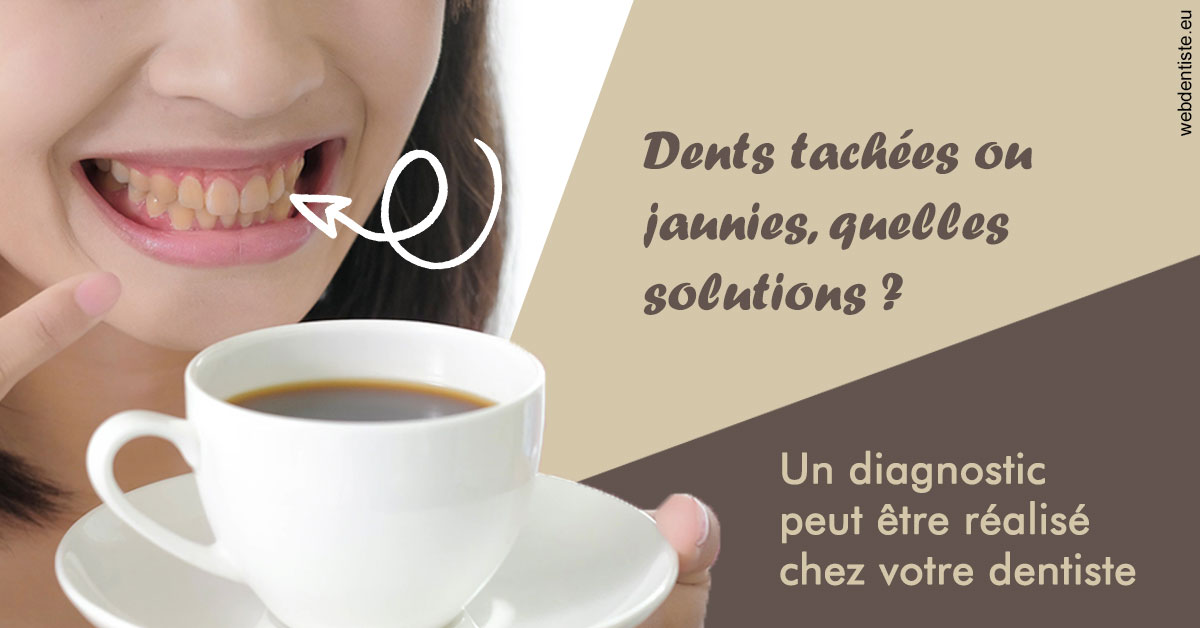 https://dr-ambert-tosi-laurence.chirurgiens-dentistes.fr/Dents tachées 1