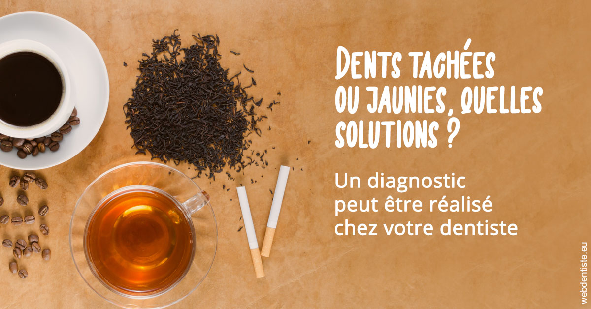 https://dr-ambert-tosi-laurence.chirurgiens-dentistes.fr/Dents tachées 2