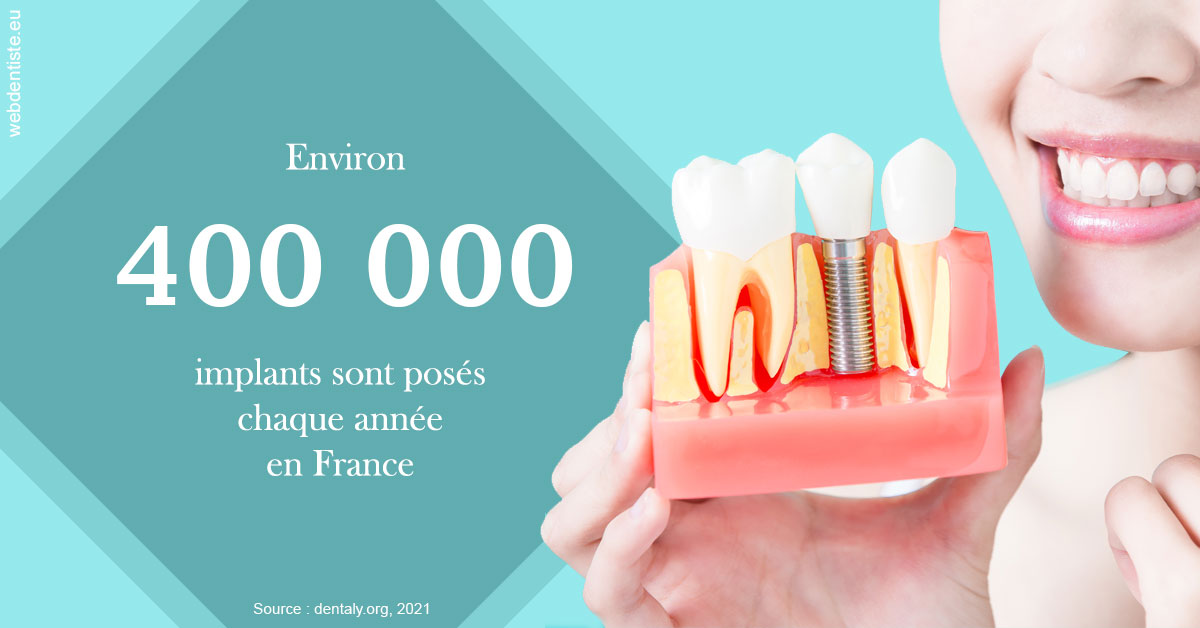 https://dr-ambert-tosi-laurence.chirurgiens-dentistes.fr/Pose d'implants en France 2