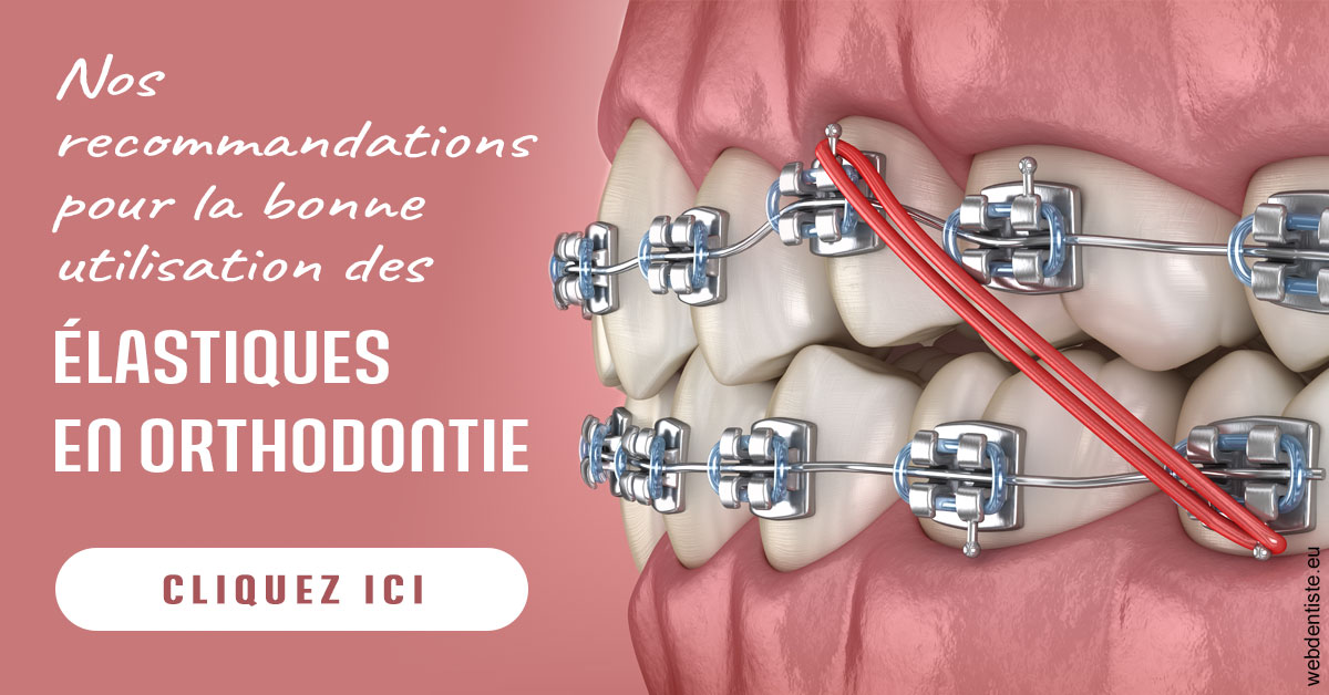 https://dr-ambert-tosi-laurence.chirurgiens-dentistes.fr/Elastiques orthodontie 2